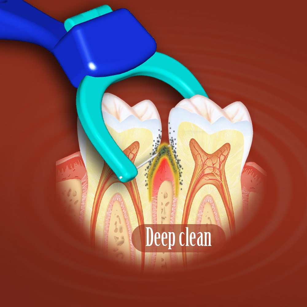 T.Smile Evolutionary Clean Dental Flossers, Kit of Refills Plus Mid-Length Handle (2 Handles + 200 Refills)