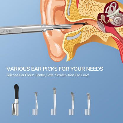 Teslong Digital Otoscope, 1080p HD Ear Camera with Ear Wax Removal Tools, Video Ear Scope Otoscope with Light, Compatible with iPhone15, iPad, Android Phone, USB, Ear Picks, Waterproof