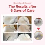 JAYU PET Black Seed Cleaner - Cat Chin Acne Treatment, Non-Toxic Hypoallergenic Cleanser, Cat Acne Chin Treatment, Remove Cat Chin Blackheads, Improves Skin Health 2.7 fl.oz (80ml) - Image 5